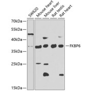 Western blot analysis of various lysates using FKBP6 Antibody at 1/1000 dilution. Secondary antibody: HRP-conjugated Goat anti-Rabbit IgG (H+L) at 1/10000 dilution. Lysates/proteins: 25 µg per lane. Blocking buffer: 3% nonfat dry milk in TBST. Exposure time: 5s.