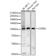 Western blot analysis of various lysates, using COPB2 Antibody at 1/500 dilution. Secondary antibody: HRP-conjugated Goat anti-Rabbit IgG (H+L) at 1/10000 dilution. Lysates/proteins: 25 µg per lane. Blocking buffer: 3% nonfat dry milk in TBST. Exposure time: 30s.