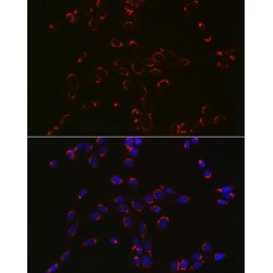 Coatomer Protein Complex Subunit Beta 2 (COPB2) Antibody