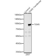 Western blot analysis of lysates from wild type (WT) and 293T cells transfected with TGM5 using TGM5 Antibody at 1/7000 dilution. Secondary antibody: HRP-conjugated Goat anti-Rabbit IgG (H+L) at 1/10000 dilution. Lysates/proteins: 25 µg per lane. Blocking buffer: 3% nonfat dry milk in TBST. Exposure time: 60s.