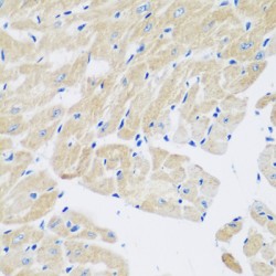 Transglutaminase 5 (TGM5) Antibody