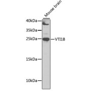 Western blot analysis of lysates from mouse brain, using VTI1B Antibody at 1/1000 dilution. Secondary antibody: HRP-conjugated Goat anti-Rabbit IgG (H+L) at 1/10000 dilution. Lysates/proteins: 25 µg per lane. Blocking buffer: 3% nonfat dry milk in TBST. Exposure time: 30s.