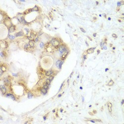 Vesicle Transport Through Interaction With T-SNAREs Homolog 1B (VTI1B) Antibody