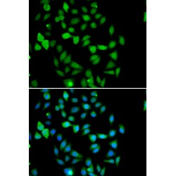 STAM-Binding Protein (STAMBP) Antibody