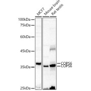 Western blot analysis of various lysates using COPS6 Antibody at 1/500 dilution. Secondary antibody: HRP-conjugated Goat anti-Rabbit IgG (H+L) at 1/10000 dilution. Lysates/proteins: 25 µg per lane. Blocking buffer: 3% nonfat dry milk in TBST. Exposure time: 60s.