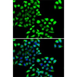 COP9 Constitutive Photomorphogenic Homolog Subunit 6 (COPS6) Antibody