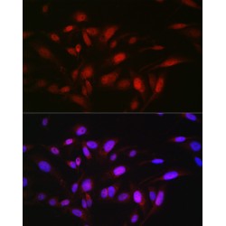 Opioid Growth Factor Receptor (OGFR) Antibody