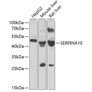 Western blot analysis of various lysates using SERPINA10 Antibody at 1/1000 dilution. Secondary antibody: HRP-conjugated Goat anti-Rabbit IgG (H+L) at 1/10000 dilution. Lysates/proteins: 25 µg per lane. Blocking buffer: 3% nonfat dry milk in TBST. Exposure time: 120s.