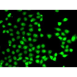 Ell-Associated Factor 2 (EAF2) Antibody