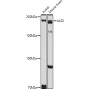 Western blot analysis of various lysates using ALS2 Antibody at 1/1000 dilution. Secondary antibody: HRP-conjugated Goat anti-Rabbit IgG (H+L) at 1/10000 dilution. Lysates/proteins: 25 µg per lane. Blocking buffer: 3% nonfat dry milk in TBST. Exposure time: 90s.