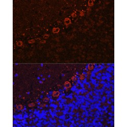 Alsin (ALS2) Antibody