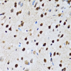 Cell Cycle and Apoptosis Regulator 2 (CCAR2) Antibody