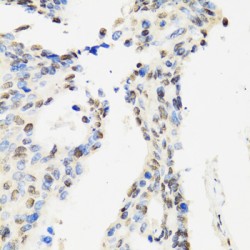 Cell Cycle and Apoptosis Regulator 2 (CCAR2) Antibody