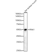 Western blot analysis of lysates from Rat skeletal muscle, using PINK1 Antibody at 1/2000 dilution. Secondary antibody: HRP-conjugated Goat anti-Rabbit IgG (H+L) at 1/10000 dilution. Lysates/proteins: 25 µg per lane. Blocking buffer: 3% nonfat dry milk in TBST. Exposure time: 90s.