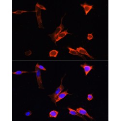 Serine/Threonine-Protein Kinase PINK1, Mitochondrial (PINK1) Antibody