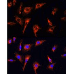 Serine/Threonine-Protein Kinase PINK1, Mitochondrial (PINK1) Antibody