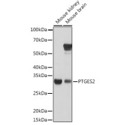 Western blot analysis of various lysates using PTGES2 Antibody at 1/1000 dilution. Secondary antibody: HRP-conjugated Goat anti-Rabbit IgG (H+L) at 1/10000 dilution. Lysates/proteins: 25 µg per lane. Blocking buffer: 3% nonfat dry milk in TBST. Exposure time: 5s.