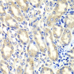 Prostaglandin E Synthase 2 (PTGES2) Antibody