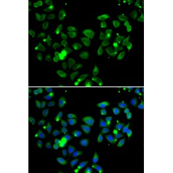 Caspase Recruitment Domain Family Member 11 (CARD11) Antibody