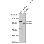 Western blot analysis of various lysates using TPH2 Antibody at 1/1000 dilution. Secondary antibody: HRP-conjugated Goat anti-Rabbit IgG (H+L) at 1/10000 dilution. Lysates/proteins: 25 µg per lane. Blocking buffer: 3% nonfat dry milk in TBST. Exposure time: 90s.