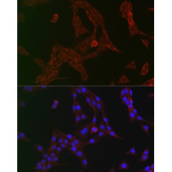 Eukaryotic Translation Initiation Factor 2 Alpha Kinase 4 (EIF2AK4) Antibody