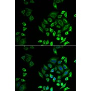 Western blot analysis of various lysates using PLA2G2D Antibody at 1/1000 dilution. Secondary antibody: HRP-conjugated Goat anti-Rabbit IgG (H+L) at 1/10000 dilution. Lysates / proteins: 25 µg per lane. Blocking buffer: 3 % nonfat dry milk in TBST. Detection: ECL Basic Kit (RM00020). Exposure time: 90s.