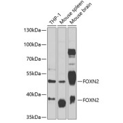 Western blot analysis of various lysates using FOXN2 Antibody at 1/1000 dilution. Secondary antibody: HRP-conjugated Goat anti-Rabbit IgG (H+L) at 1/10000 dilution. Lysates/proteins: 25 µg per lane. Blocking buffer: 3% nonfat dry milk in TBST. Exposure time: 90s.