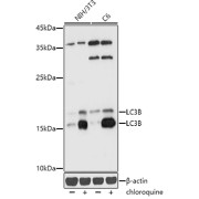 Western blot analysis of various lysates using [KD Validated] LC3B Antibody at 1/1000 dilution. NIH/3T3 and C6 cells were treated by Chloroquine (50 µM) at 37 °C for 20 hours. Secondary antibody: HRP-conjugated Goat anti-Rabbit IgG (H+L) at 1/10000 dilution. Lysates/proteins: 25 µg per lane. Blocking buffer: 3% nonfat dry milk in TBST. Exposure time: 1s.