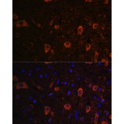 Microtubule-Associated Proteins 1A/1B Light Chain 3B (MAP1LC3B) Antibody