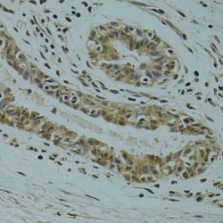 Arginine And Serine Rich Coiled-Coil 1 (RSRC1) Antibody