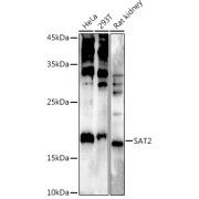 Western blot analysis of various lysates using at 1/500 dilution. Secondary antibody: HRP-conjugated Goat anti-Rabbit IgG (H+L) at 1/10000 dilution. Lysates/proteins: 25 µg per lane. Blocking buffer: 3% nonfat dry milk in TBST. Exposure time: 90s.