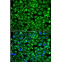 Thialysine N-Epsilon-Acetyltransferase (SAT2) Antibody