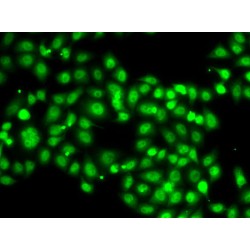 SET Binding Protein 1 (SETBP1) Antibody