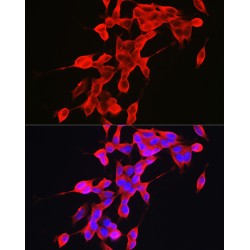 Alpha Synuclein (SNCA) Antibody