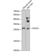 Western blot analysis of various lysates using SOX14 Antibody at 1/1000 dilution. Secondary antibody: HRP-conjugated Goat anti-Rabbit IgG (H+L) at 1/10000 dilution. Lysates/proteins: 25 µg per lane. Blocking buffer: 3% nonfat dry milk in TBST. Exposure time: 90s.