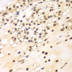 Breast Carcinoma Amplified Sequence 3 (BCAS3) Antibody