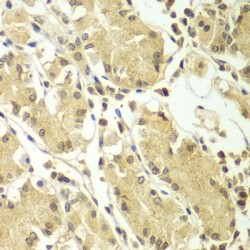 Breast Carcinoma Amplified Sequence 3 (BCAS3) Antibody