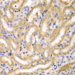 Breast Carcinoma Amplified Sequence 3 (BCAS3) Antibody