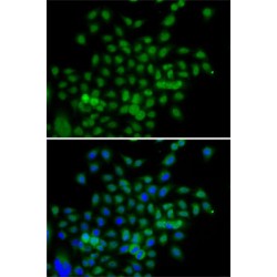 Breast Carcinoma Amplified Sequence 3 (BCAS3) Antibody