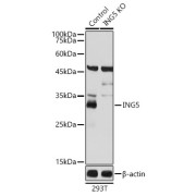 Western blot analysis of lysates from wild type (WT) and ING5 knockout (KO) 293T cells, using [KO Validated] ING5 Antibody at 1/1000 dilution. Secondary antibody: HRP-conjugated Goat anti-Rabbit IgG (H+L) at 1/10000 dilution. Lysates/proteins: 25 µg per lane. Blocking buffer: 3% nonfat dry milk in TBST. Exposure time: 1s.