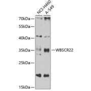 Western blot analysis of various lysates using WBSCR22 Antibody at 1/1000 dilution. Secondary antibody: HRP-conjugated Goat anti-Rabbit IgG (H+L) at 1/10000 dilution. Lysates/proteins: 25 µg per lane. Blocking buffer: 3% nonfat dry milk in TBST. Exposure time: 30s.