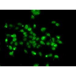 Williams-Beuren Syndrome Chromosomal Region 22 Protein (WBSCR22) Antibody