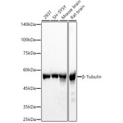 Western blot analysis of various lysates, using β-Tubulin Antibody at 1/2000 dilution. Secondary antibody: HRP-conjugated Goat anti-Rabbit IgG (H+L) at 1/10000 dilution. Lysates/proteins: 25 µg per lane. Blocking buffer: 3% nonfat dry milk in TBST. Exposure time: 1s.