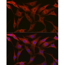 Tubulin Beta (TUBB) Antibody