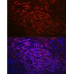 B-Cell Antigen Receptor Complex-Associated Protein Alpha Chain (CD79A) Antibody