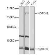 Western blot analysis of various lysates using NOTCH2 Antibody at 1/1000 dilution. Secondary antibody: HRP-conjugated Goat anti-Rabbit IgG (H+L) at 1/10000 dilution. Lysates/proteins: 25 µg per lane. Blocking buffer: 3% nonfat dry milk in TBST. Exposure time: 5s.
