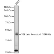 Western blot analysis of lysates from 293T cells, using TGF beta Receptor I (TGFBR1) Antibody at 1/1000 dilution. Secondary antibody: HRP-conjugated Goat anti-Rabbit IgG (H+L) at 1/10000 dilution. Lysates/proteins: 25 µg per lane. Blocking buffer: 3% nonfat dry milk in TBST. Exposure time: 180s.