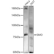 Western blot analysis of various lysates using SMO Antibody at 1/500 dilution. Secondary antibody: HRP-conjugated Goat anti-Rabbit IgG (H+L) at 1/10000 dilution. Lysates/proteins: 25 µg per lane. Blocking buffer: 3% nonfat dry milk in TBST. Exposure time: 120s.