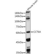 Western blot analysis of lysates from Mouse brain, using CCT6A Antibody at 1/1000 dilution. Secondary antibody: HRP-conjugated Goat anti-Rabbit IgG (H+L) at 1/10000 dilution. Lysates/proteins: 25 µg per lane. Blocking buffer: 3% nonfat dry milk in TBST. Exposure time: 10s.