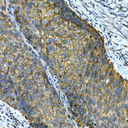 Integrin Alpha 2 (ITGA2) Antibody